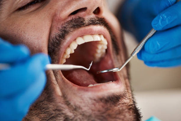 Best Urgent Tooth Repair  in Somers, WI